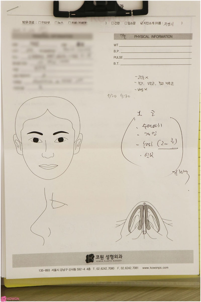 압구정로데오성형외과 두꺼운코 콤플렉스 해결