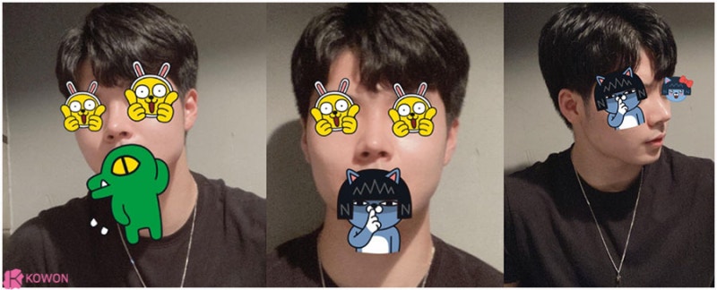 압구정로데오성형외과 두꺼운코 콤플렉스 해결 사진 7