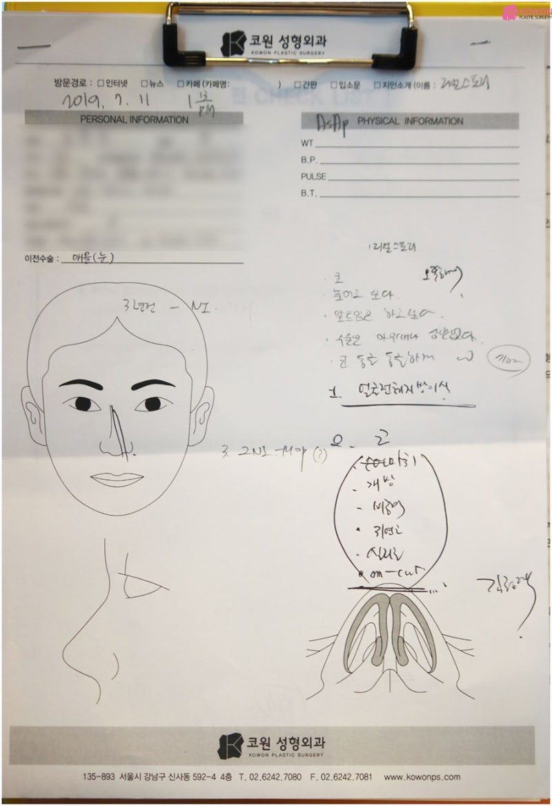 작은코성형 방법 이마 납작한 여성 환자 귀연골코수술후기