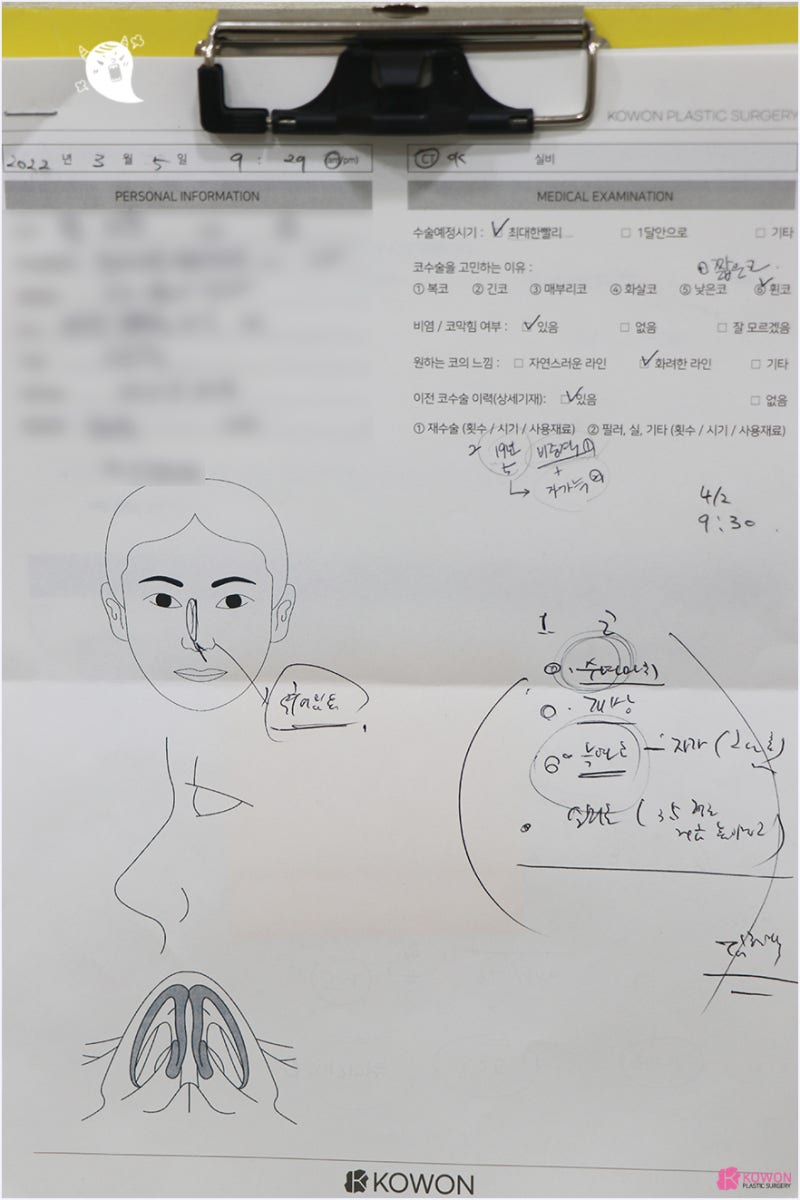 구축코 코재성형 원인 증상 부작용 형태 인상