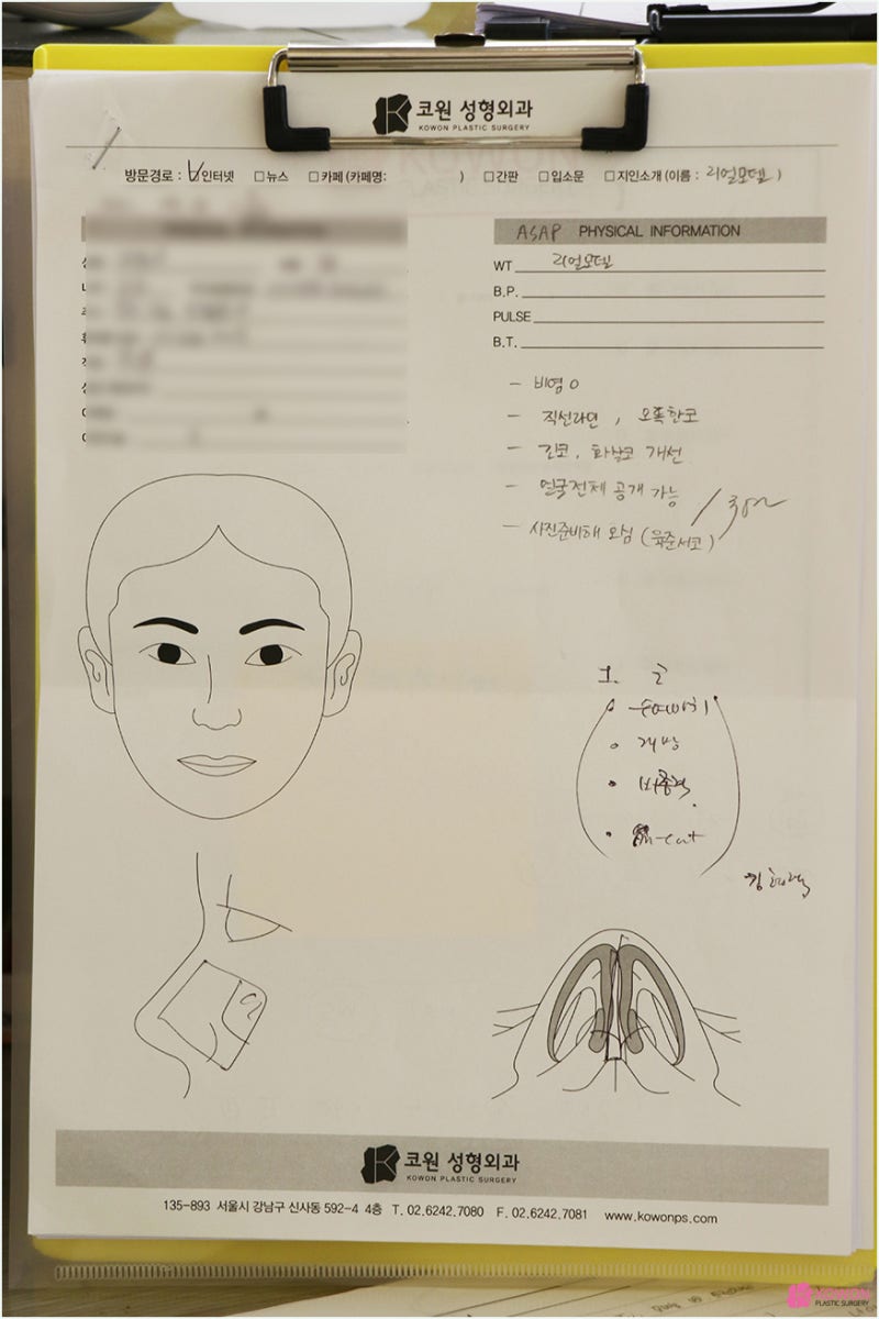 강남코성형 날렵한코 모양 라인 비교 진단 방법