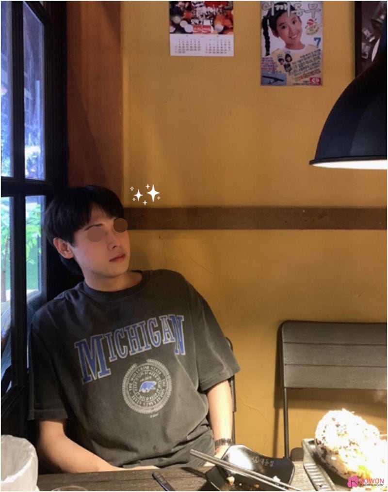 강남코성형 날렵한코 모양 라인 비교 진단 방법 사진 9