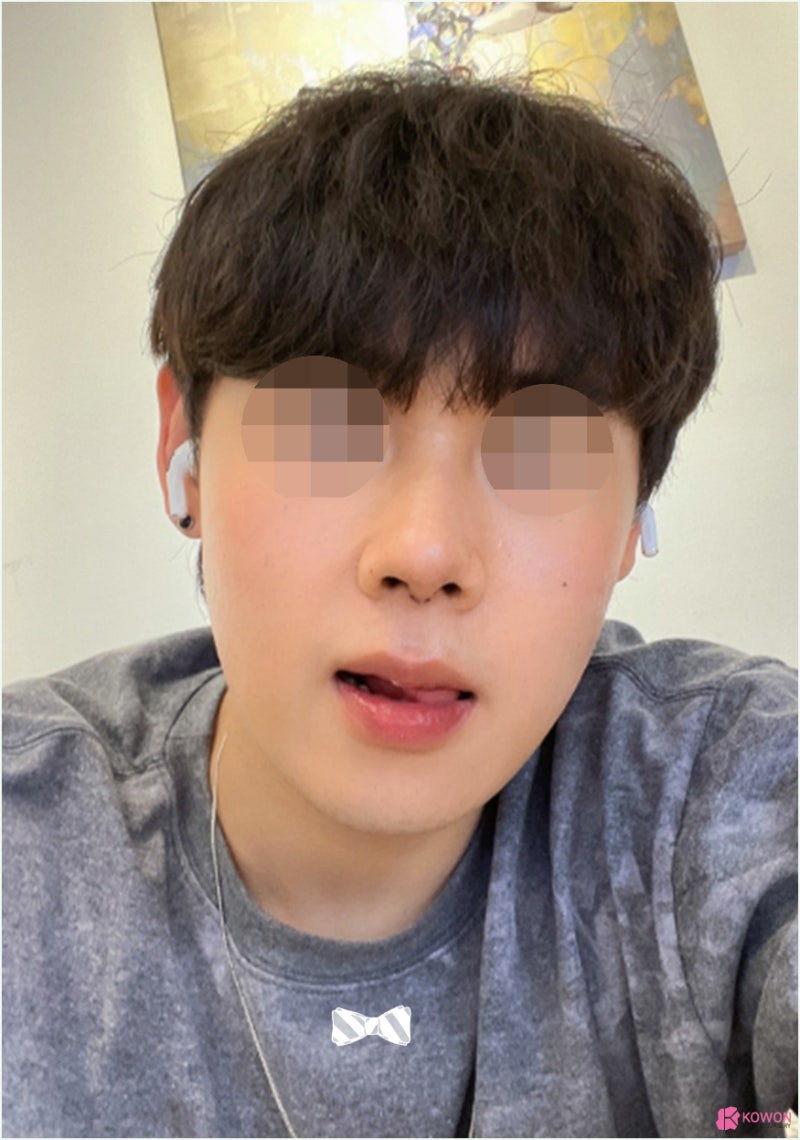 강남코성형 날렵한코 모양 라인 비교 진단 방법 사진 5