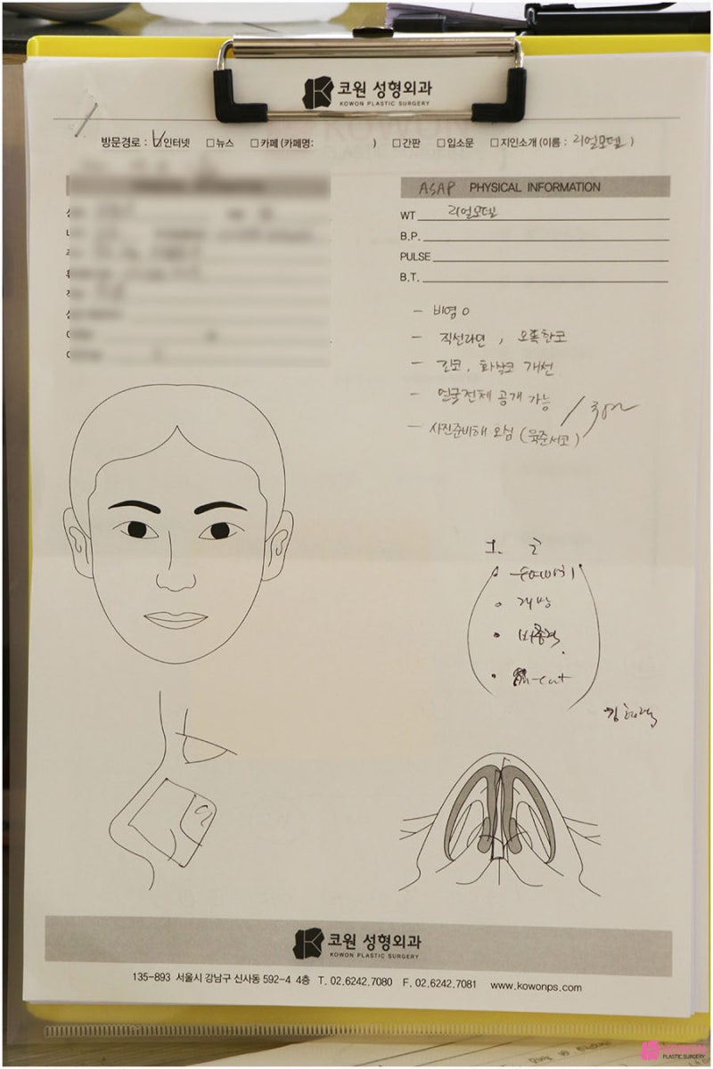 역삼동성형외과 심미성까지 잡은 강남비중격코수술