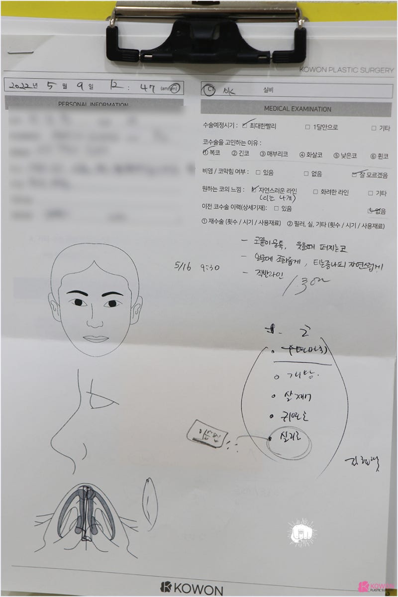 강남코성형외과추천 콧볼수술후기 문의 변화 전후차이