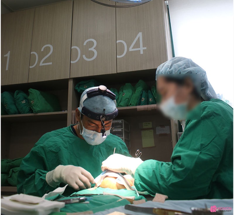 코재수술잘하는병원 자가 늑 이용한 콧볼줄이기 사진 3