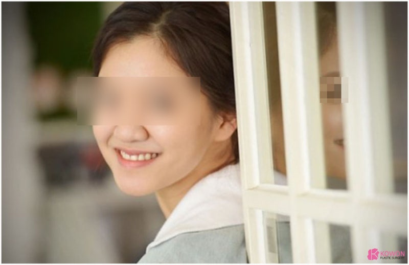 코필러후유지기간 특성 성분 코끝 콧대 부위 사진 5