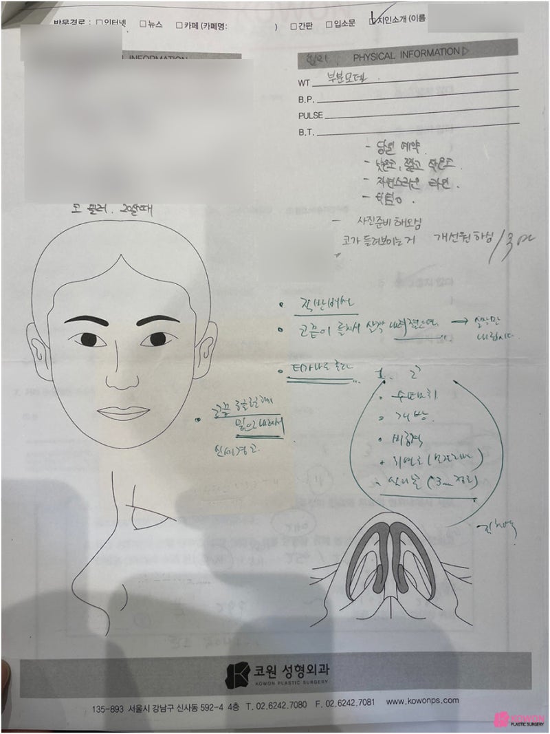 필러후코수술 코성형변화 디자인 직반버선 콧대