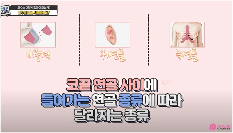 신사역코수술 코성형시뮬레이션 설명 진행 작업 특징 용도 사진 6