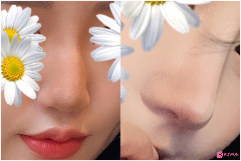 오똑한코 후기 화려한 모양 코필러녹음 방법 특징