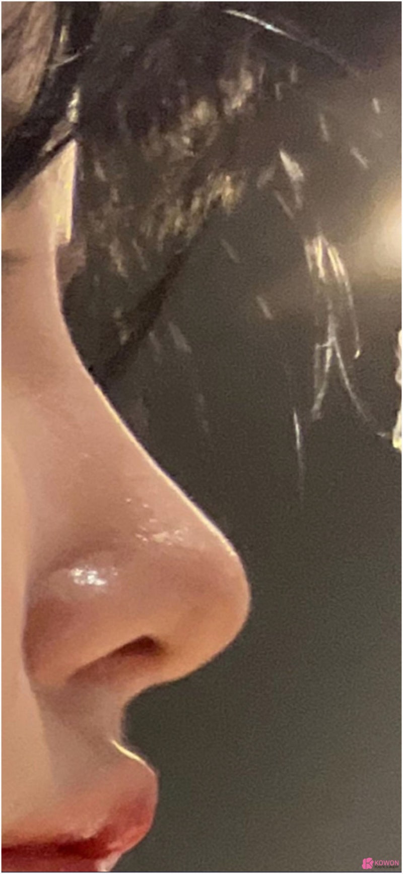 오똑한코 후기 화려한 모양 코필러녹음 방법 특징 사진 9