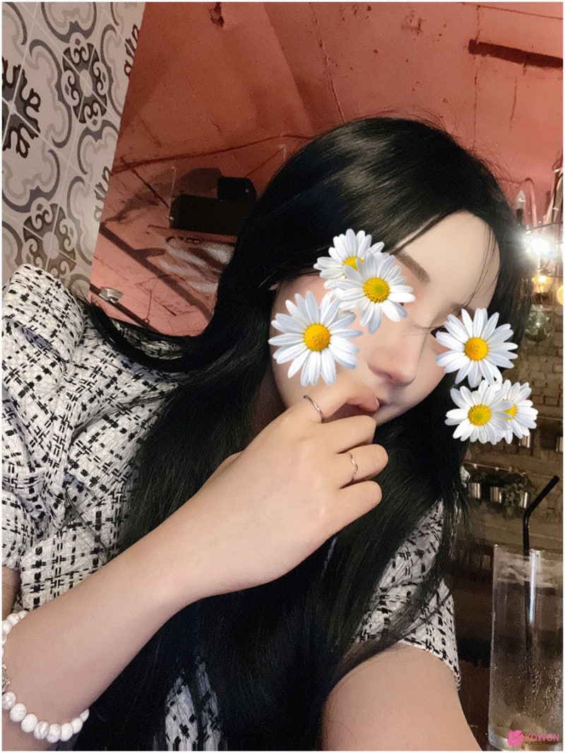 오똑한코 후기 화려한 모양 코필러녹음 방법 특징 사진 4