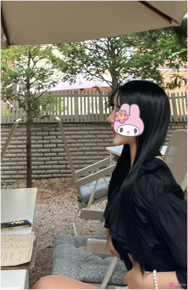 오똑한코 후기 화려한 모양 코필러녹음 방법 특징 사진 7