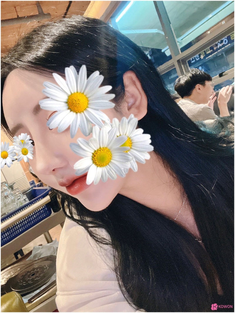 오똑한코 후기 화려한 모양 코필러녹음 방법 특징 사진 5