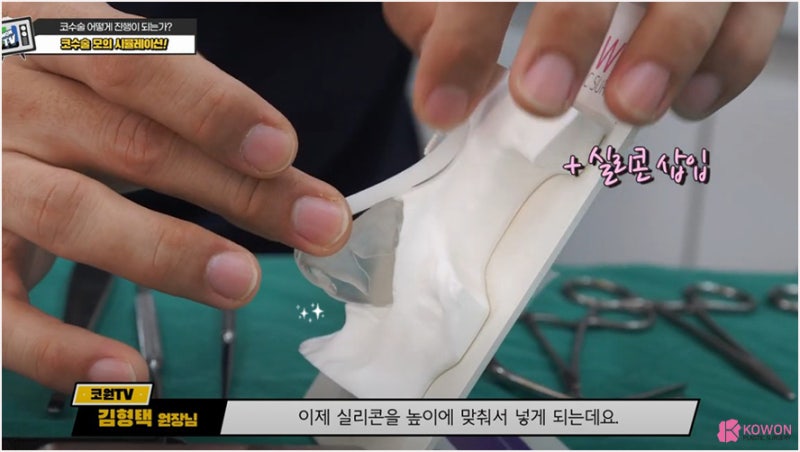 성형외과수술실 설명 매부리코수술방법 시뮬레이션 사진 5