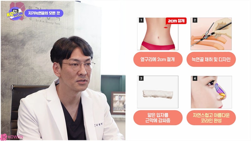 강남유명한성형외과 연골코성형 재료 종류 특징 사진 13