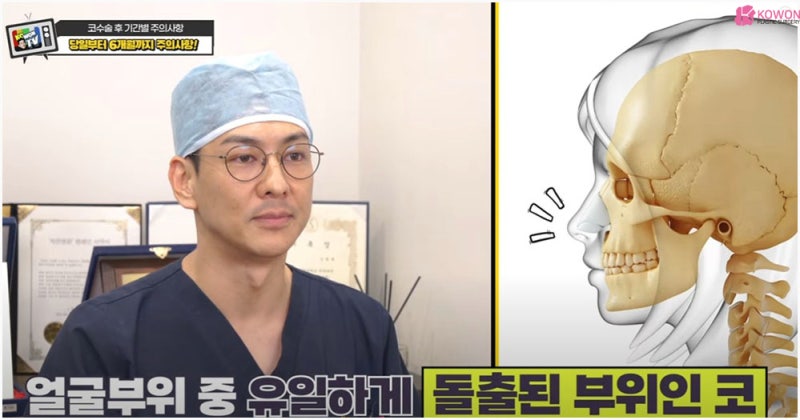 코수술후주의사항 당일 2주 코성형찜질 방법