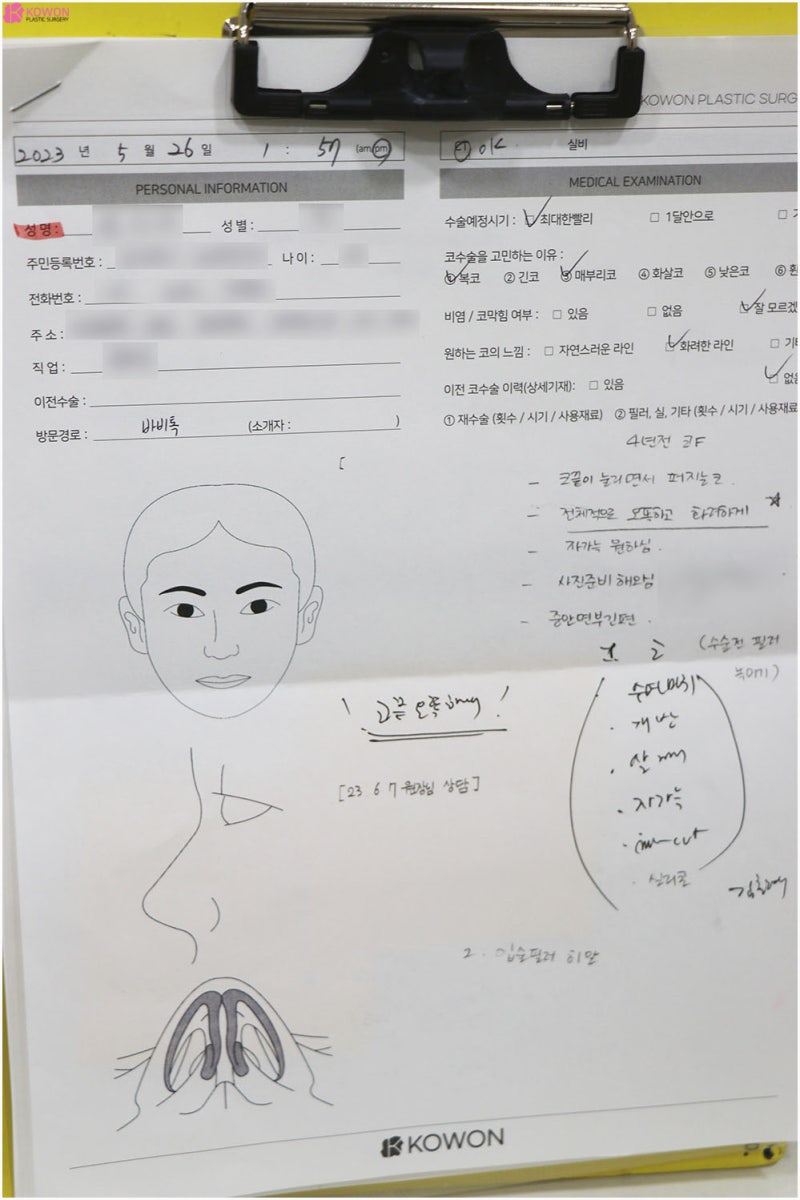 학동역성형외과 뭉툭한 복코 개선 바비톡후기