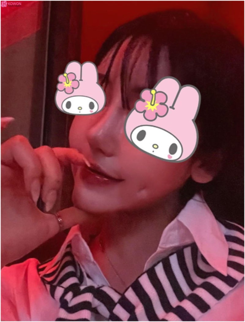 학동역성형외과 뭉툭한 복코 개선 바비톡후기 사진 6