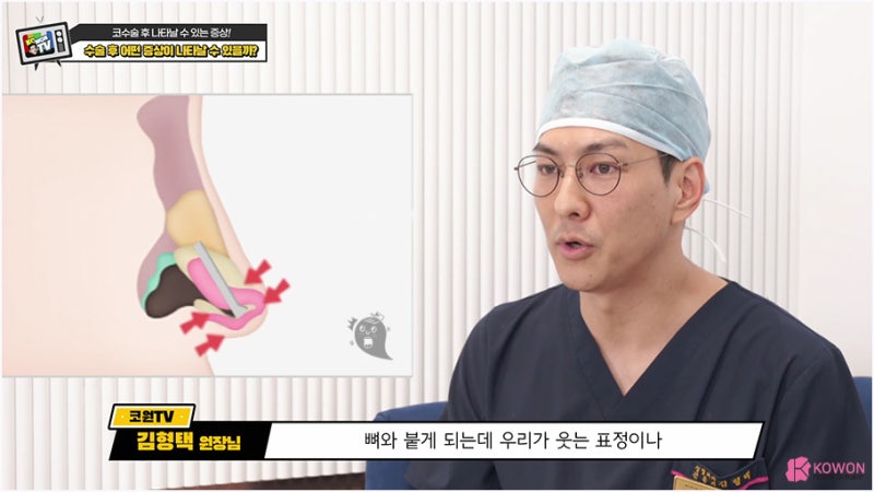 신사코성형외과 미간코수술 코피 통증 부작용 사진 6