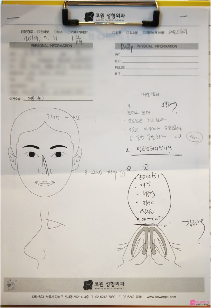 강남구청성형외과 낮은코높이기 수술 후 화려한 이미지