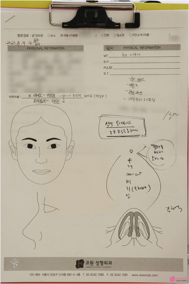 압구정동성형외과 동글코 개선 후 고급스러운 인상