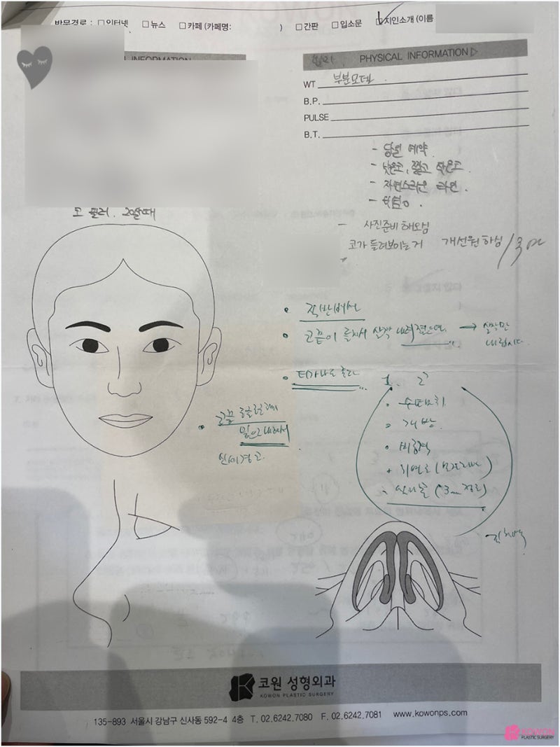 강남압구정성형외과 필러 제거 낮은콧대 수술