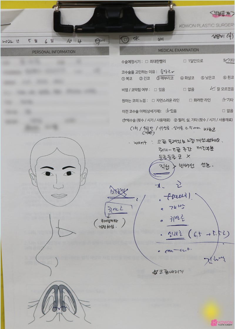 가로수길성형외과 코수술실리콘부작용 콧구멍 디자인