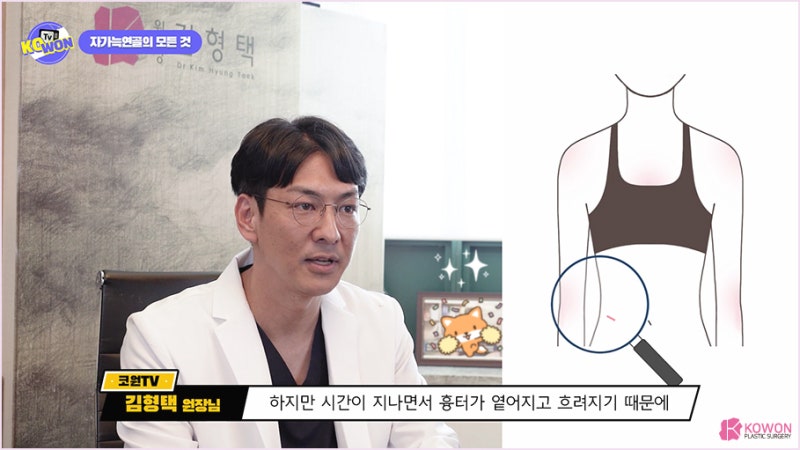 서울성형외과추천 코연골휨 라인 재건 방법 사진 9