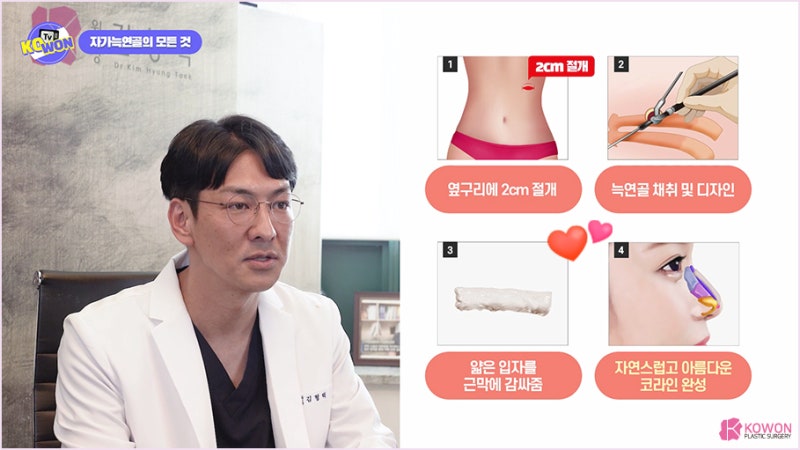 서울성형외과추천 코연골휨 라인 재건 방법 사진 13