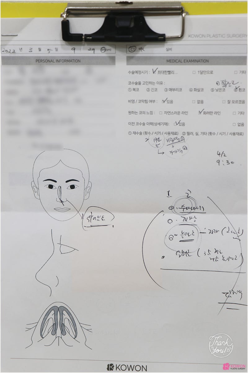 남자코성형외과 들창코수술전후 구축 이미지 개선