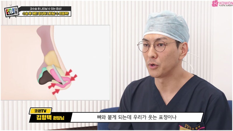 강남 성형외과 출혈 통증 코가땡겨요 수술 후 증상 사진 6