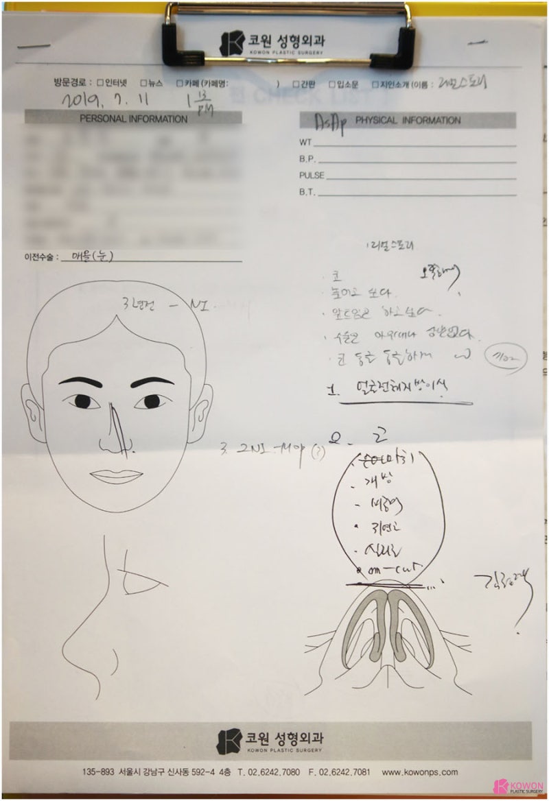 작은코수술 통한 여성스러운 이미지 변화 압구정동코성형