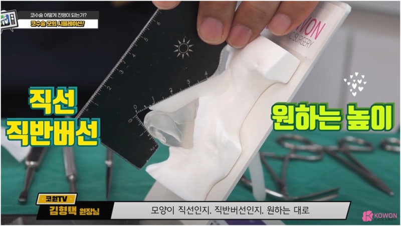 매부리코성형후기 코연골 콧대 높이 실리콘 절개 흉터 사진 7