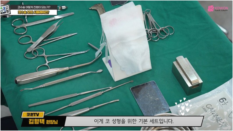 매부리코성형후기 코연골 콧대 높이 실리콘 절개 흉터 사진 2