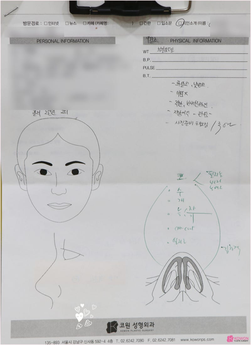 화살코수술 기증늑연골코수술 고민 흉터 부기