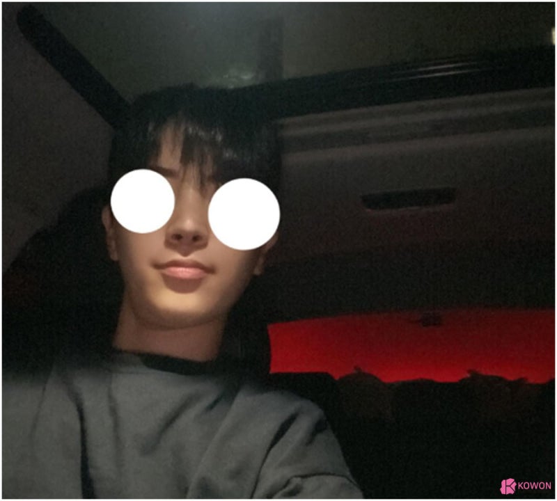 논현역성형외과 남자 서울코재수술 사례 사진 9
