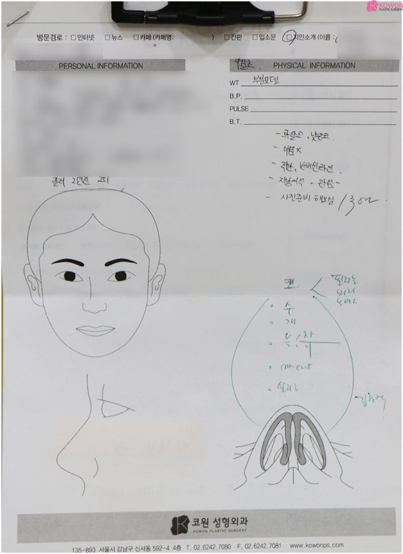 늑연골코수술 방법 특징 강남신사동성형외과