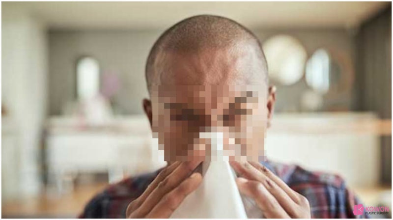 코허는이유 증상 원인 코안이헐었을때 대처 방법 사진 6