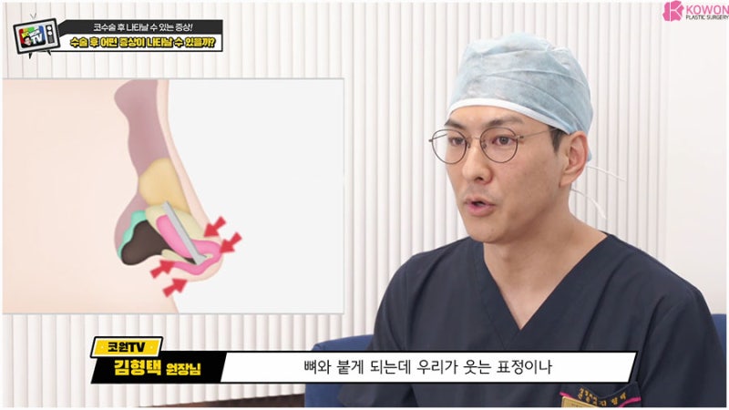 코성형부작용 코피 출혈 통증 이상 증상 사진 6