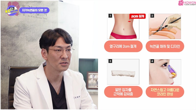 자가조직코성형 장단점 늑연골흉터 유지력 사진 13