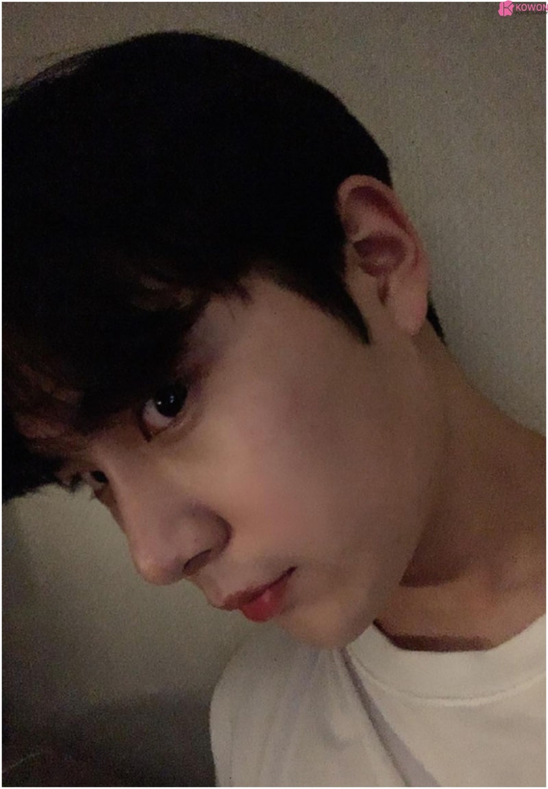 서초동성형외과 화려한 모양 남성코성형 잘하는 곳 사진 8