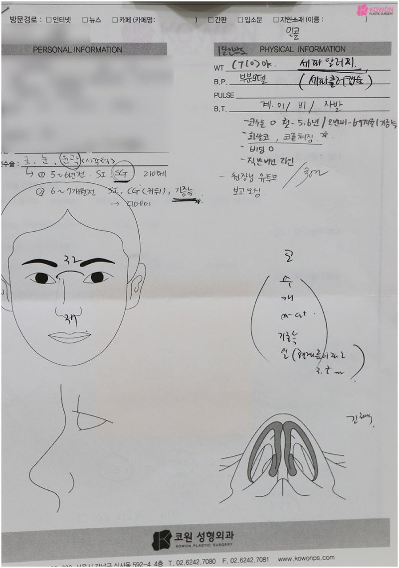 서울코성형잘하는곳 비순각 여자코수술후기 사진 2