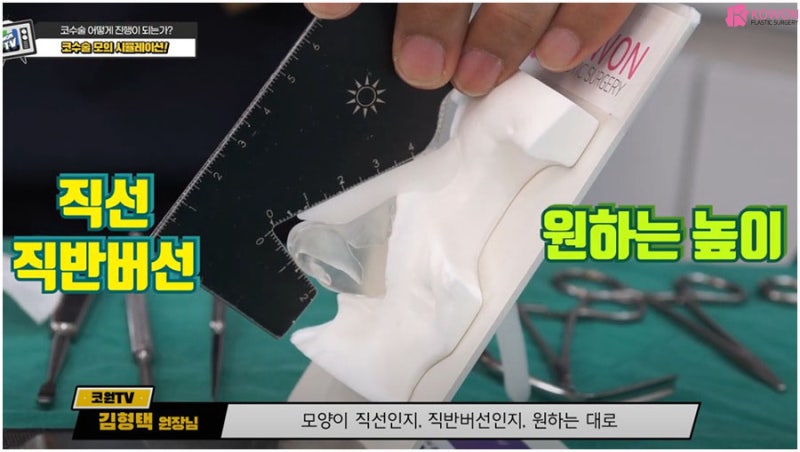매부리코성형 방법 과정 특징 코성형전문의 사진 7