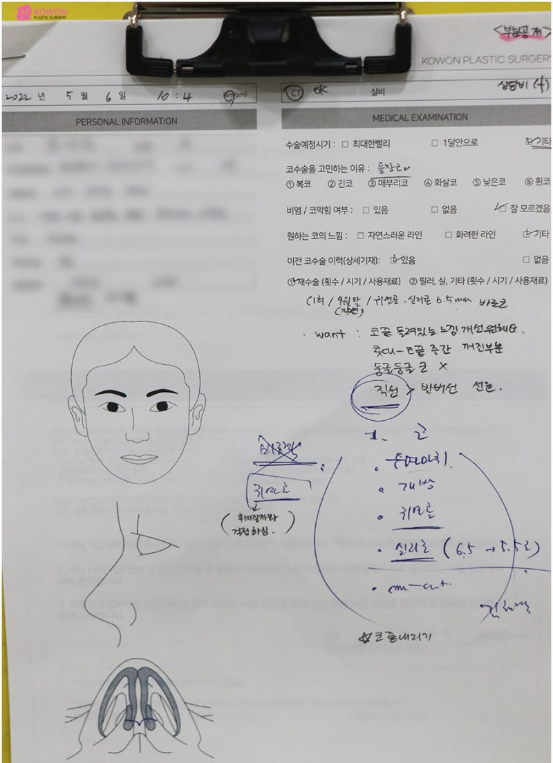 코실리콘부작용 비주 튀어나옴 해결 강남구청성형외과