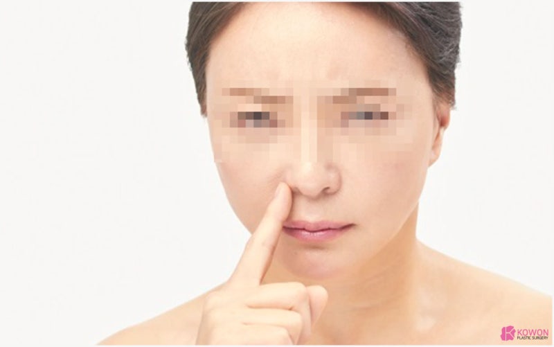 코점막부음 비대증 냄새 후각 문제 대처 예방 사진 4