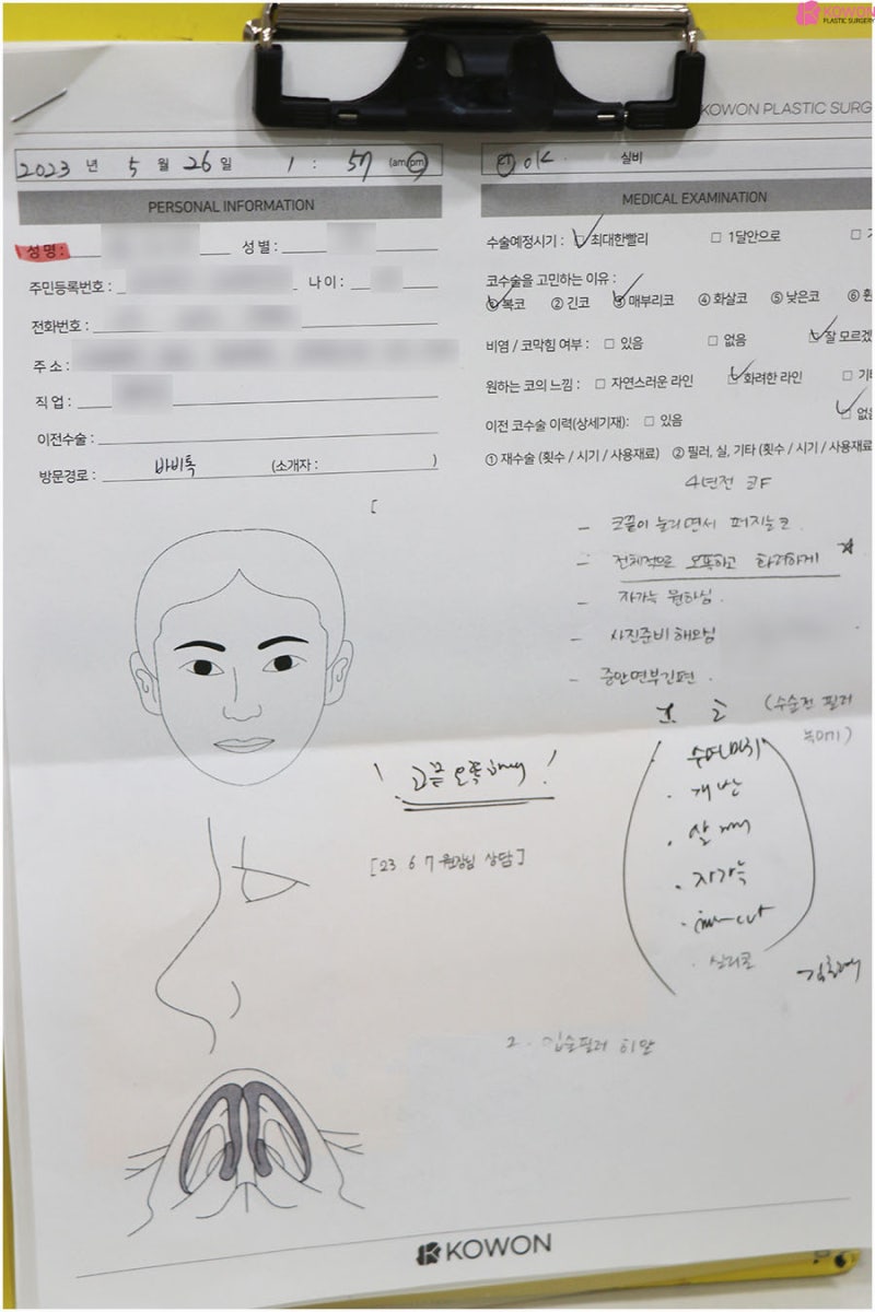 신사역성형외과추천 코자가늑수술 사례 전후 비교