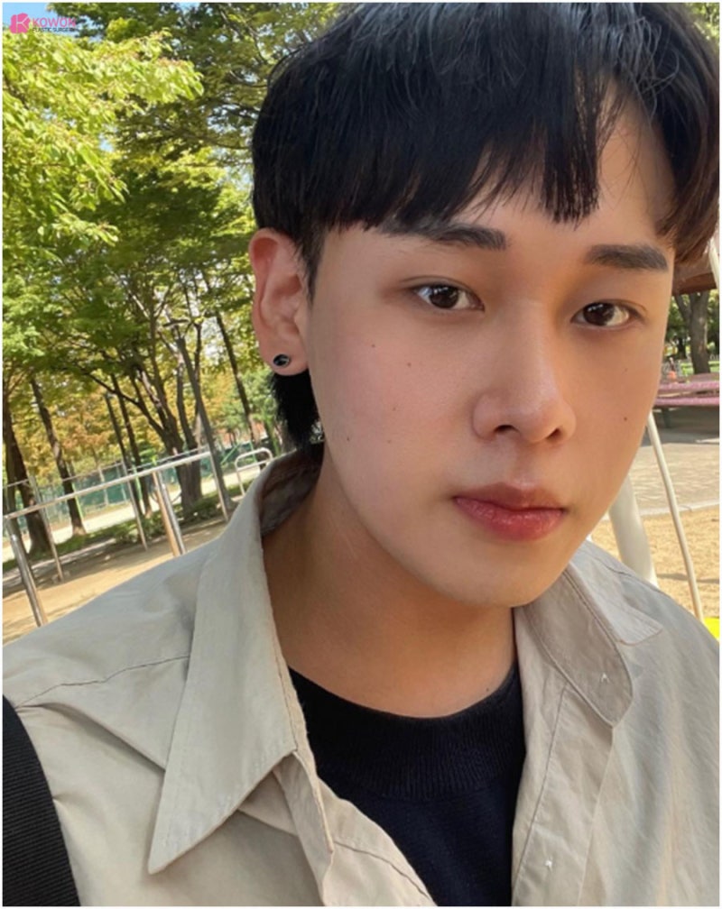 비염기능코성형 뭉툭한 코끝 개선 강남유명성형외과 사진 10