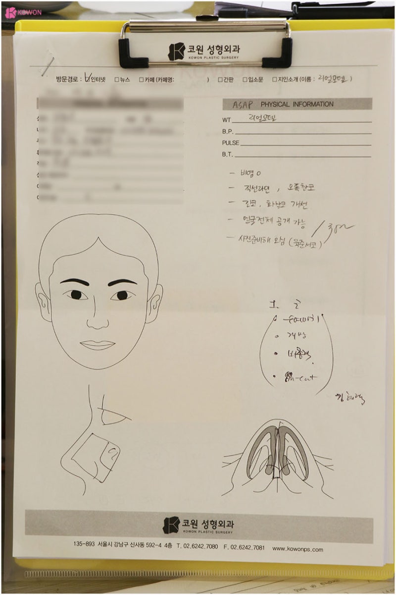 비염기능코성형 뭉툭한 코끝 개선 강남유명성형외과