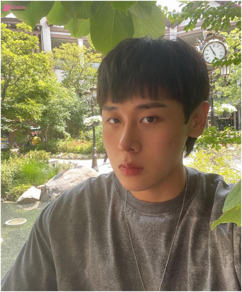 비염기능코성형 뭉툭한 코끝 개선 강남유명성형외과 사진 8